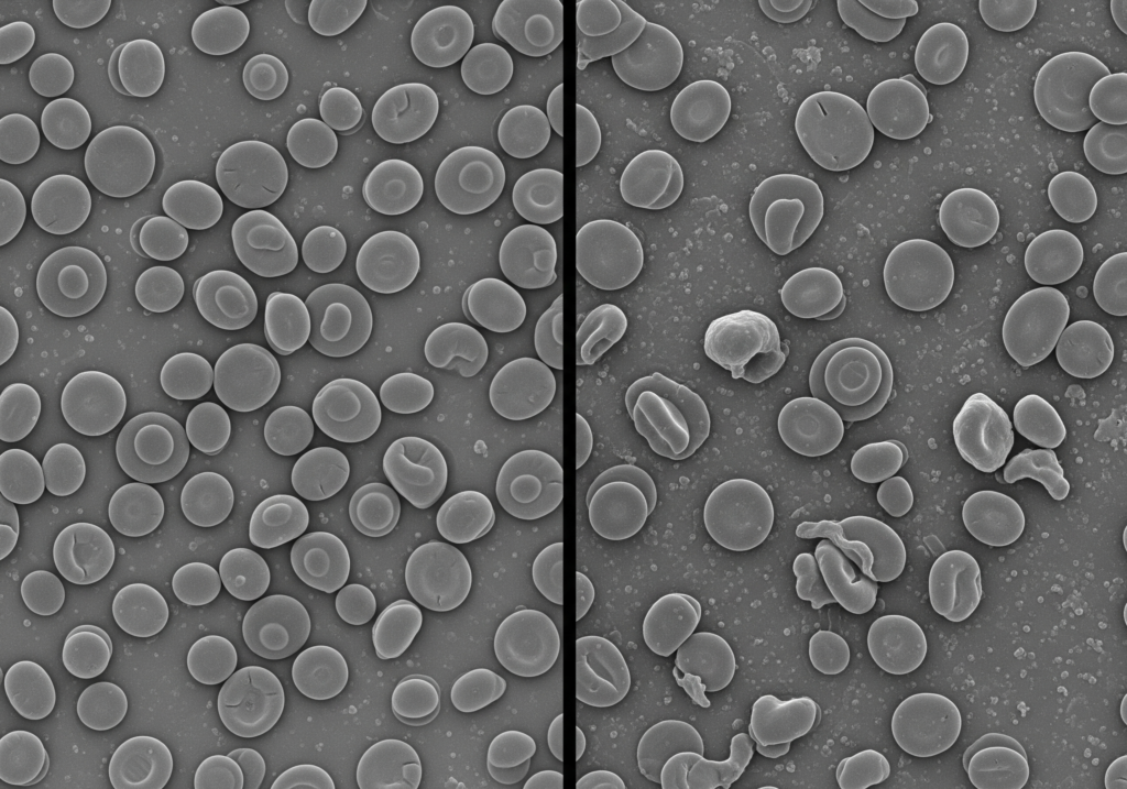 Microscopic Blood Analysis