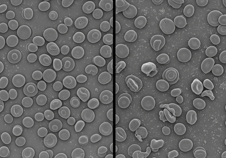 Microscopic Blood Analysis